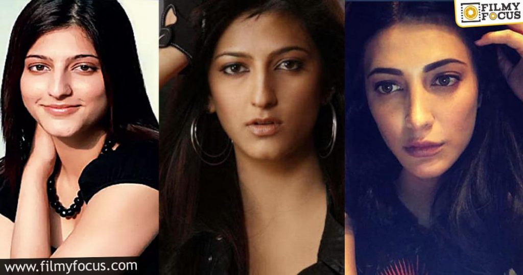 Actress Shruti Haasan Reveals About Her Plastic Surgery1