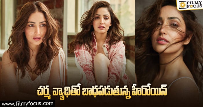 Yami Gautam: యామీ గౌతమ్ కి అరుదైన వ్యాధి.. ట్రీట్మెంట్ కూడా లేదట!