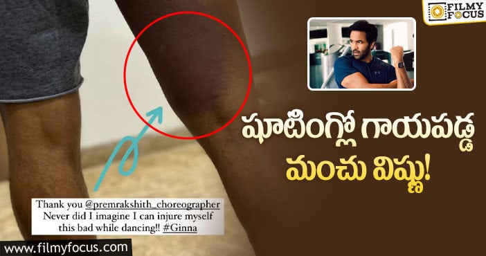 Manchu Vishnu: మంచు విష్ణుకి గాయాలు..అయినా థాంక్స్ చెబుతూ పోస్ట్..!