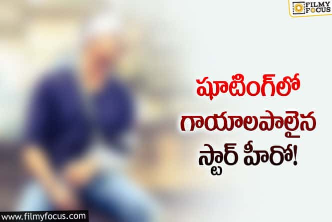 ప్రమాదంలో గాయపడ్డ స్టార్ హీరో ఎవరంటే..?