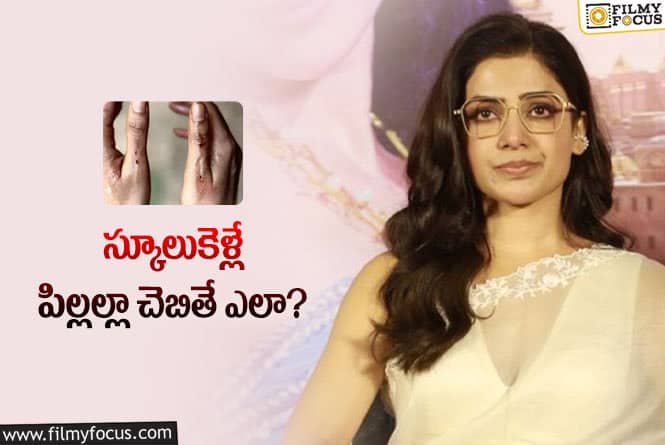 Samantha: సమంత గాయాలపై రెండుగా చీలిన సోషల్‌ మీడియా.. ఎందుకిలా?