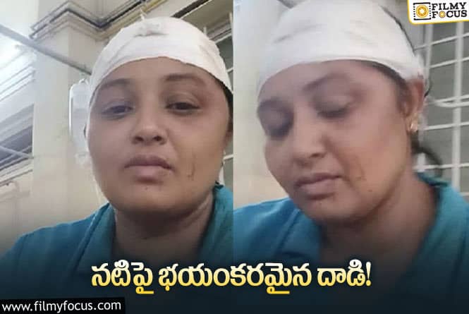 Anu Gowda: గాయాలతో హాస్పిటల్ పాలైన నటి.. కారణం అదే..!