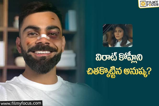 Virat Kohli: మొహం మీద గాయాలతో విరాట్… ఫోటో వైరల్!