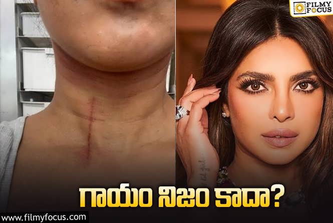 Priyanka Chopra: షూటింగ్‌లో ప్రియాంకకు గాయం.. నిజం కాదా? ఏం జరిగింది?