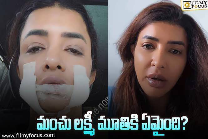 Manchu Lakshmi: బ్యాండేజ్లతో మంచు లక్ష్మీ.. షాకిస్తున్న ఫోటో.!