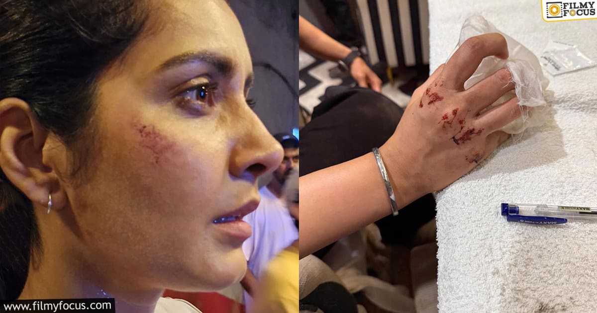 Rashi Khanna Injured During Action Sequence On The Sets (1)